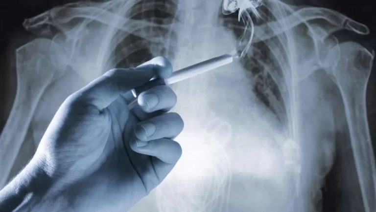 Día Mundial Sin Tabaco: el cáncer de pulmón uno de los que más muertes causa en Argentina