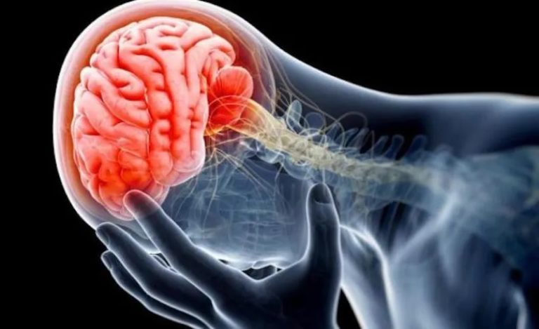 Alertan que el riesgo de meningitis aumenta con la llegada de la primavera